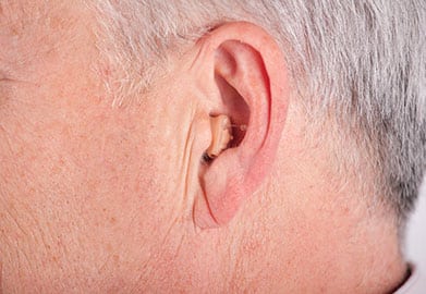 Completely-in-Canal (CIC) Hearing Aids