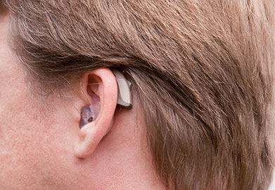 Behind-The-Ear (BTE) Hearing Aids