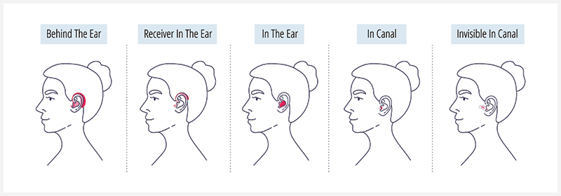 Types and Style of Hearing Aids