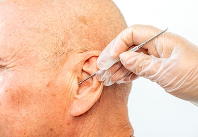 What Happens When Earwax Builds Up? 